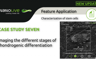 Imaging label-free live chondrogenic differentiation, with a focus on the early morphological changes mesenchymal stem cells undergo on the way to becoming cartilage tissue
