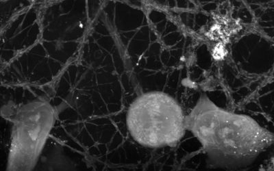 Nanolive label-free cell imaging captures microglia; neurons immune surveillance system hard at work