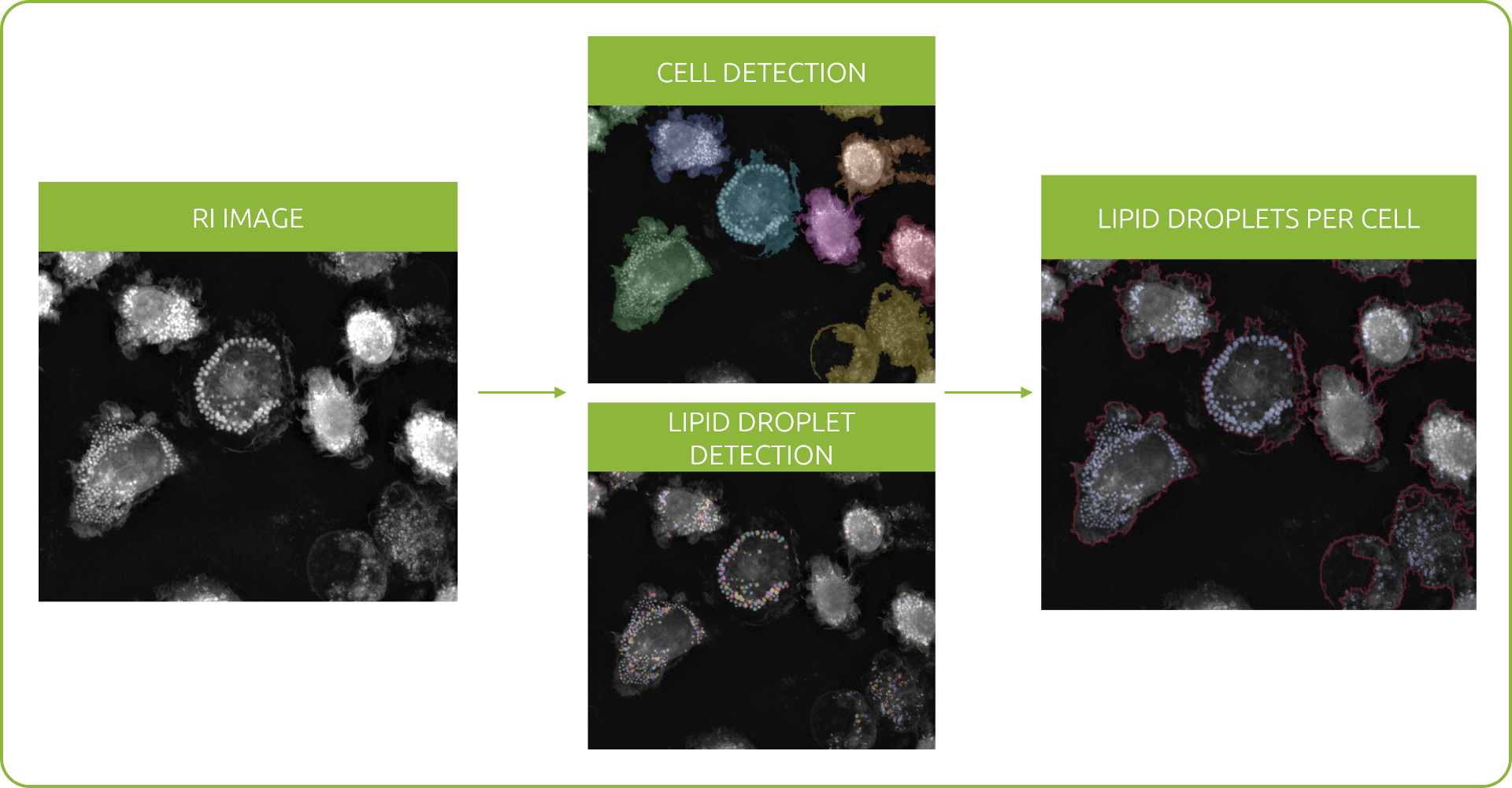 Image generation workflow in Nanolive's Smart Lipid Droplet Assay LIVE, from refractive (RI) image to lipid droplets per cell segmentation