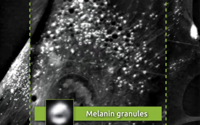 Non-invasive, label-free visualization of melanin granules using Nanolive cell imaging