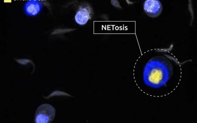 Nanolive imaging reveals NETosis to play a key role in host-pathogen interactions in Animal African trypanosomosis