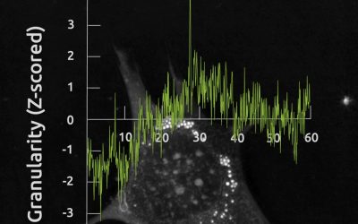 Nanolive examines nuclear changes following transcription inhibition, in real time, and label-free