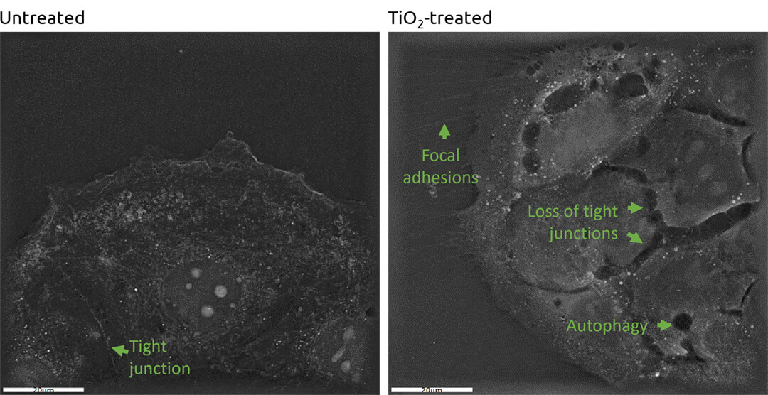 TiO2 nanoparticle effects on cellular morphology.