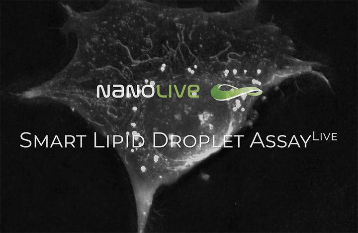 Nanolive launches the Smart Lipid Droplet Assay LIVE