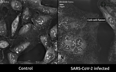 Nanolive imaging suggests that cell-cell fusion could play a key role in the SARS-CoV-2 infection process