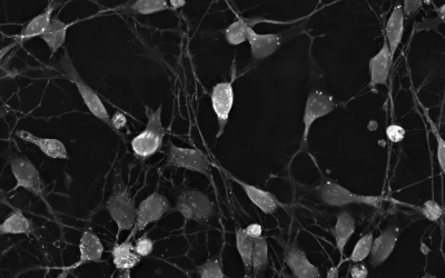 Idorsia - Differentiation of LUHMES neuronal precursor cells into mature dopaminergic neurons