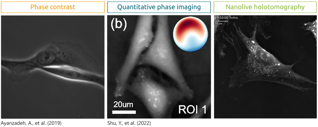 Nanolive’s holotomography: an imaging technique combining holography and tomography.