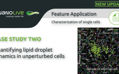 Quantifying lipid droplet dynamics in unperturbed cells, label-free