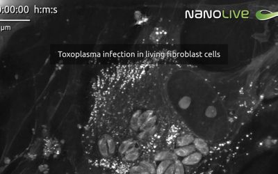 Label-free live cell imaging of Toxoplasma gondii infection dynamics in mammalian cells