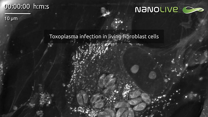 Label-free live cell imaging of Toxoplasma gondii infection dynamics in mammalian cells